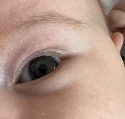 Baby eye colour