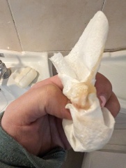 Is this my bloody show? TMI photos