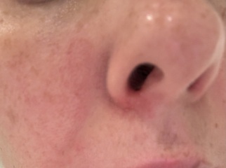 Help - my skin is a mess