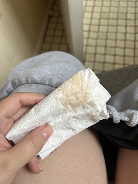 Brown discharge