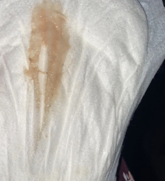 38 weeks preg, what’s this in pad?
