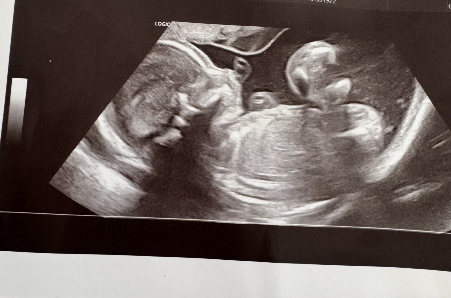 Have I ruined the gender surprise? :(