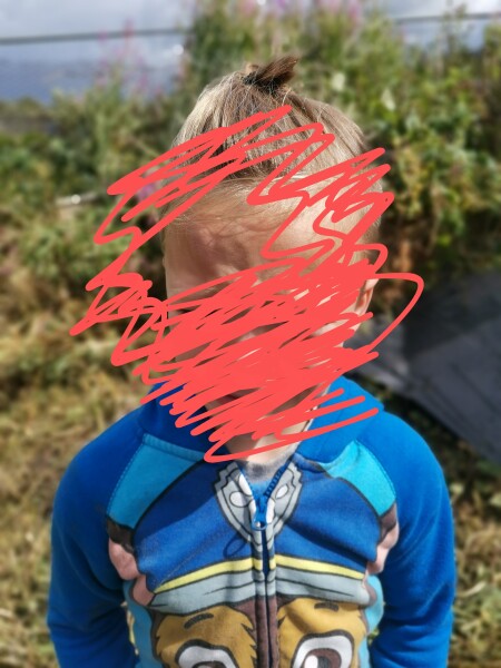 Share the pain of a gardening 'incident'