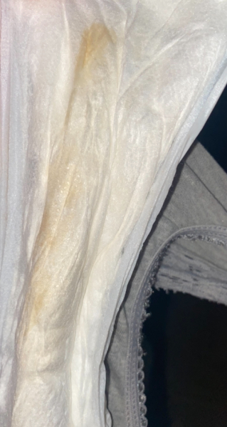 38 weeks preg, what’s this in pad?