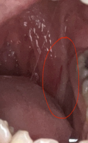 Would you go to the dentist with a sore throat?