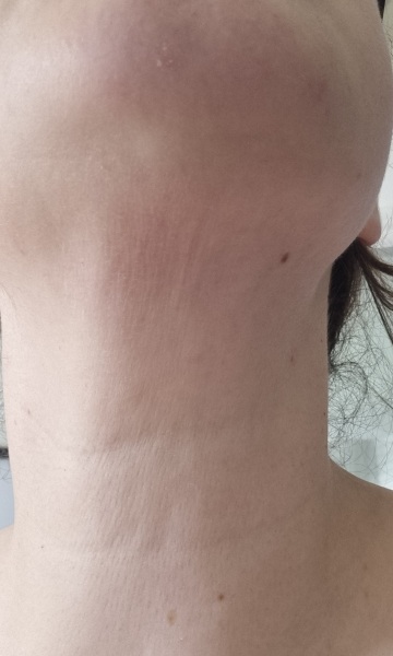 Continuing Mounjaro...part 13