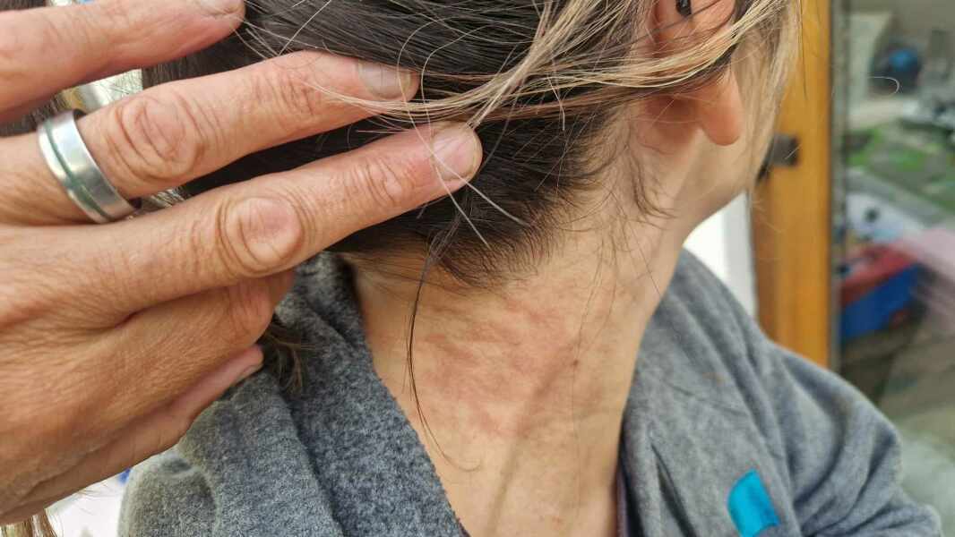Boots nor Superdrug couldn't diagnose this, maybe one of you can?