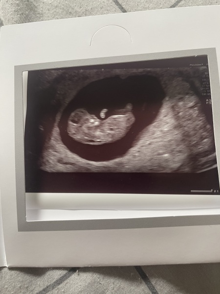 Gender???