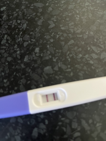 pregnancy continues after bleed?