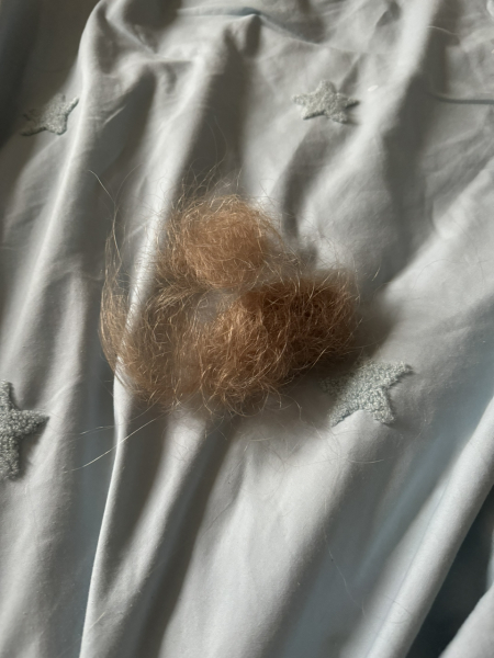 Mounjaro / Wegovy with > 5st / 30kg to lose