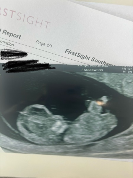 Boy or girl