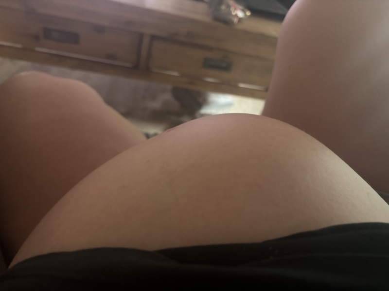 Head bulges in belly