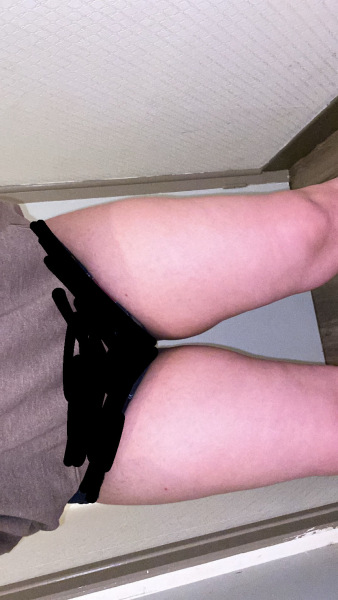 loose skin (help)