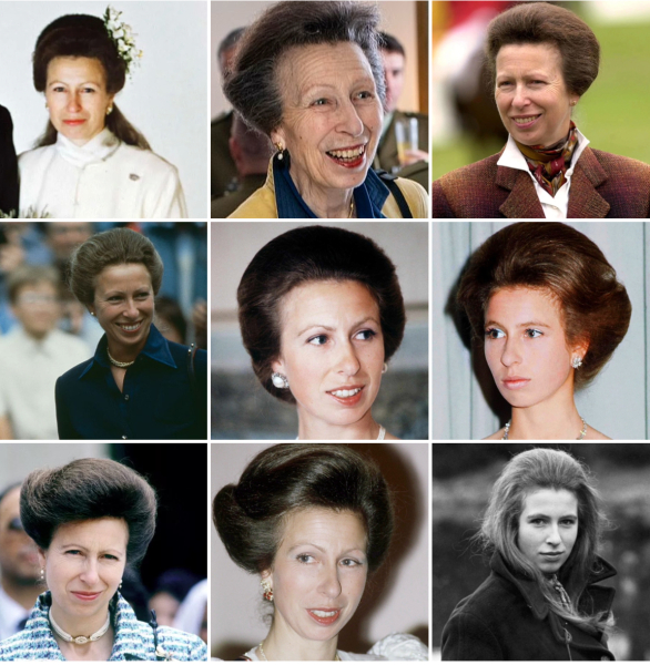 Princess Anne in hospital