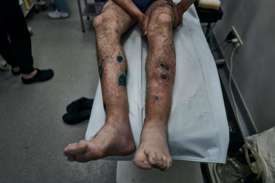 Ukraine Invasion: Part 50