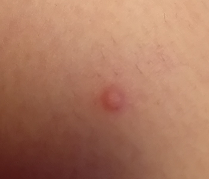 Should I worry about this growth?