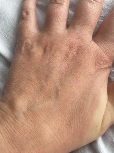 Help! My hands (picture included)