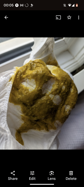 Is it dairy sensitivity?