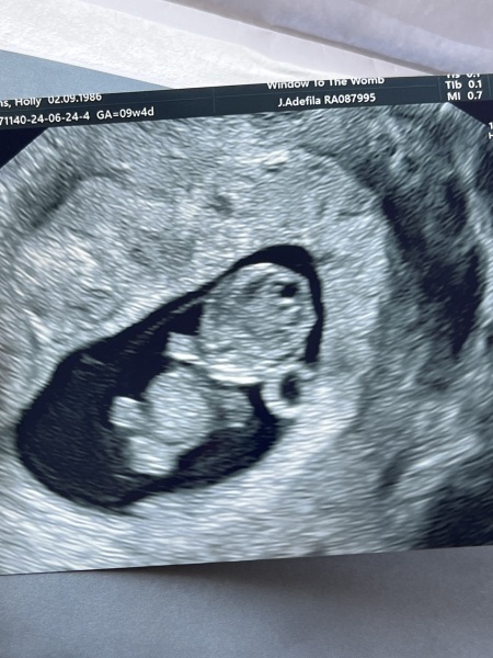 BFP after IVF - anyone want to join me in the wait for first scan?