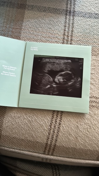 Gender help!