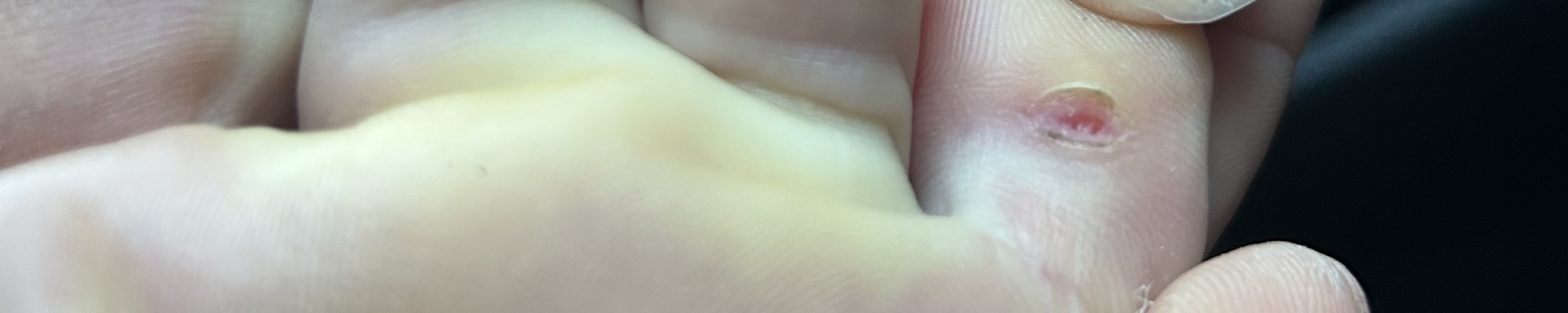 Cut won't heal! Any ideas?