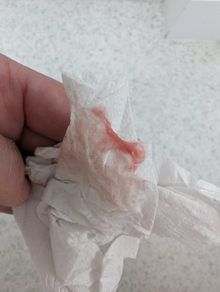 Trigger Warning: Conception after miscarriage, when do I test for another pregnancy? *edited by MNHQ