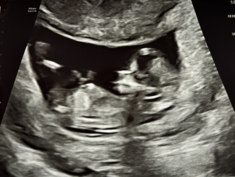 Fun gender guesses?!