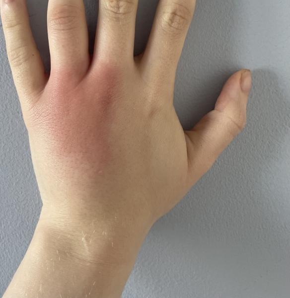 What is wrong with my hand?!