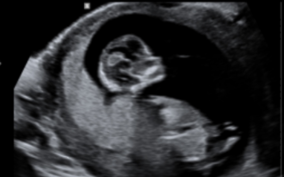 Guess the gender💖💙