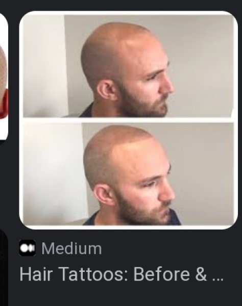 DS 15 going bald - anything he/we can do?