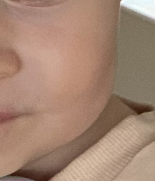 What to put on baby scar? Or will it heal by itself?