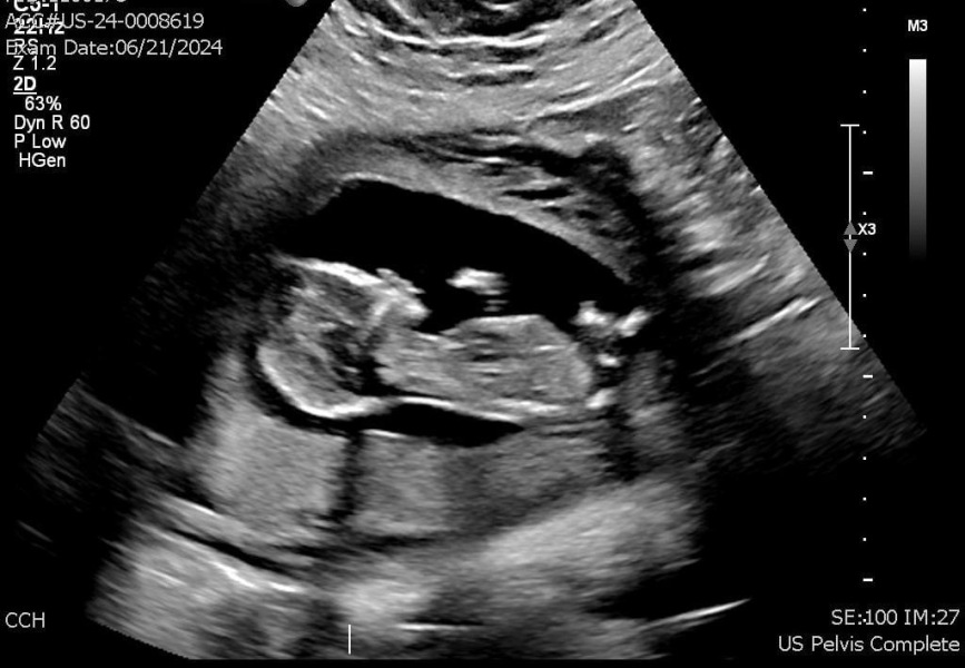 Is this a girl or a boy?
