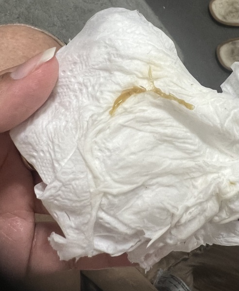 Mucas Plug?