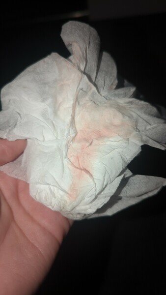 4 weeks 2 days and bleeding