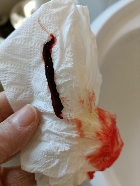 Period pains on HRT!! Anyone else? (TMI photo in comments)