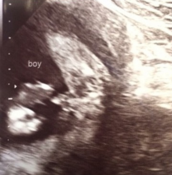 Is this definitely a girl?