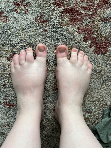 The doctor doesn't know what's wrong with my foot