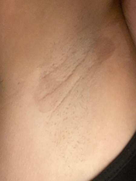 Health anxiety sufferer- gp appointment