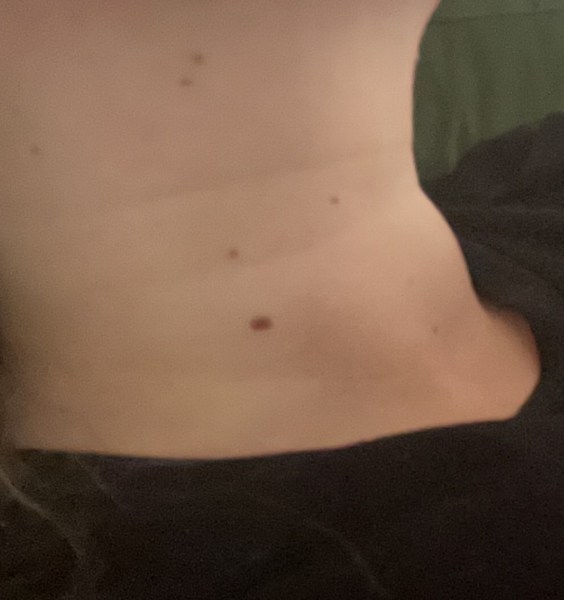 Wtf has happened to my thyroid?!