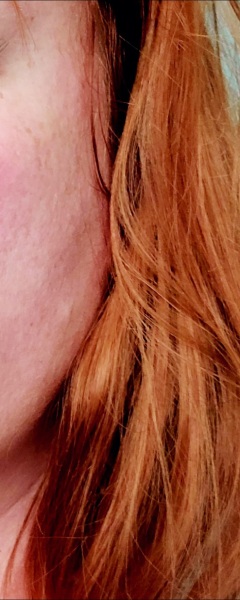 What do we think of ‘gingerism’?