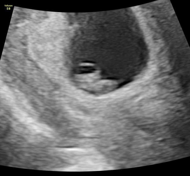 Due February 2025 - Thread 2