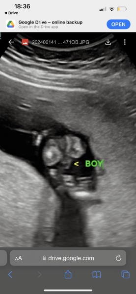 Gender scan