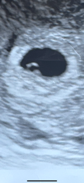 Help is this normal 5 weeks 5days?