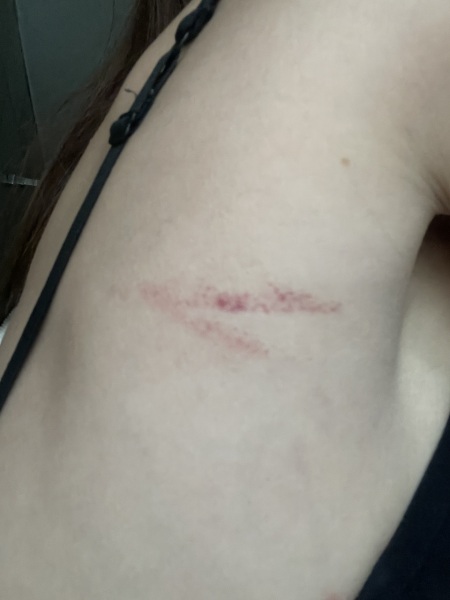 Any idea what this mark/rash could be?