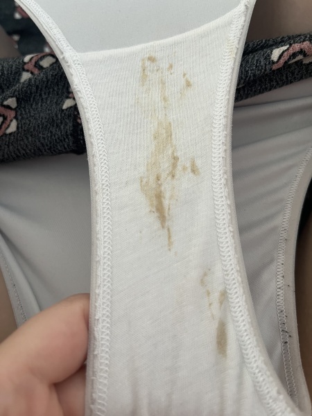 5w pregnant - does this discharge look normal?