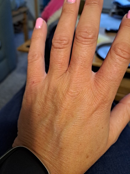 Help! My hands (picture included)