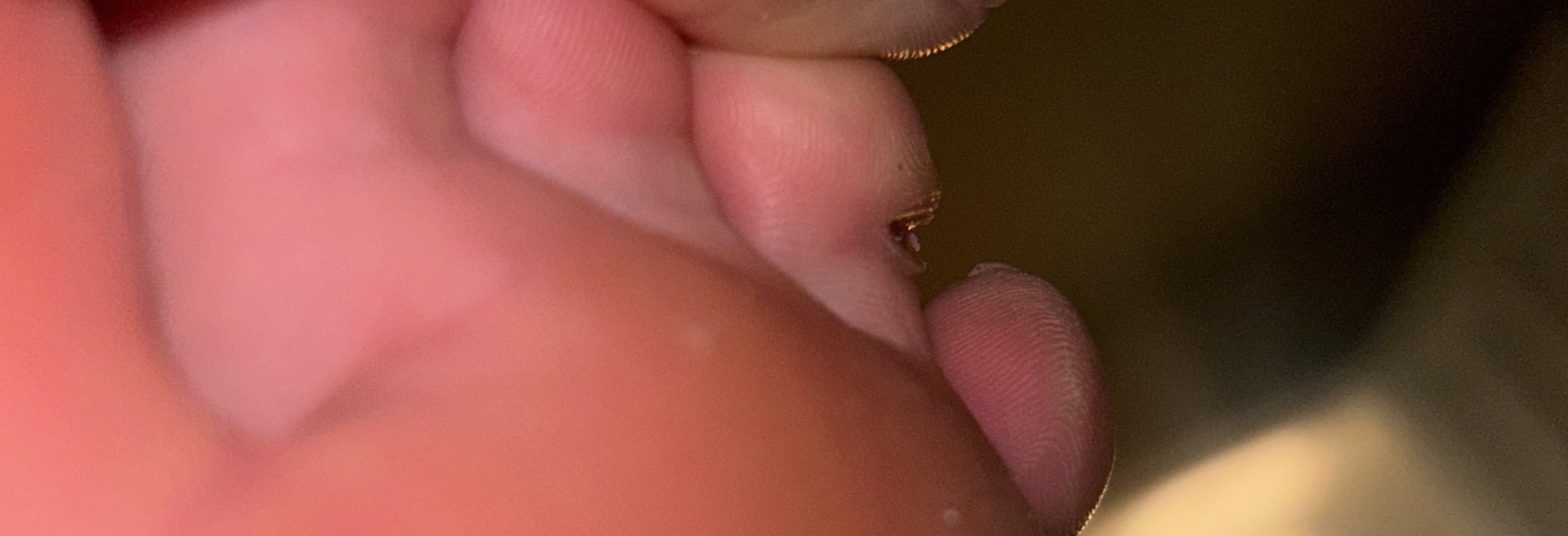 I'm so much pain. Is this normal? Pic warning!