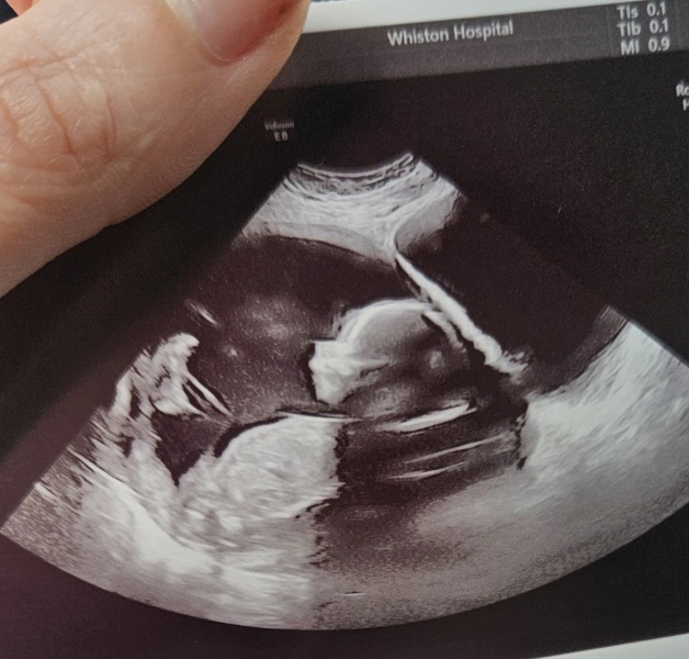 TTC May 2023 💝 Previous MC March 2023 (thread 4)