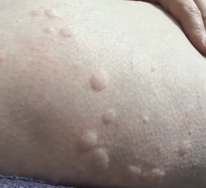 What’s this on my skin?! Pic included