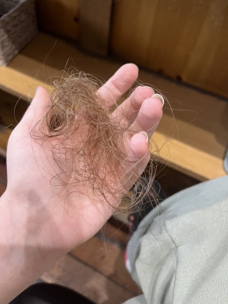 Does this look like much hair loss.